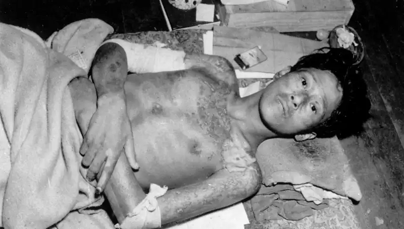 80 Yıl Sonra Nagasaki’den Şok Edici Uyarı: Nükleer Tehdit Gerçek mi?