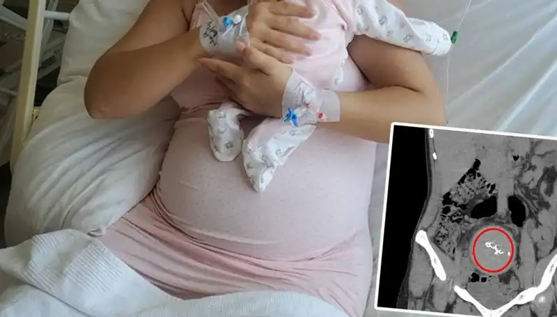 Doğumda Unutulan Bebek: Gazlı Bez İhmalinin Feci Sonuçları