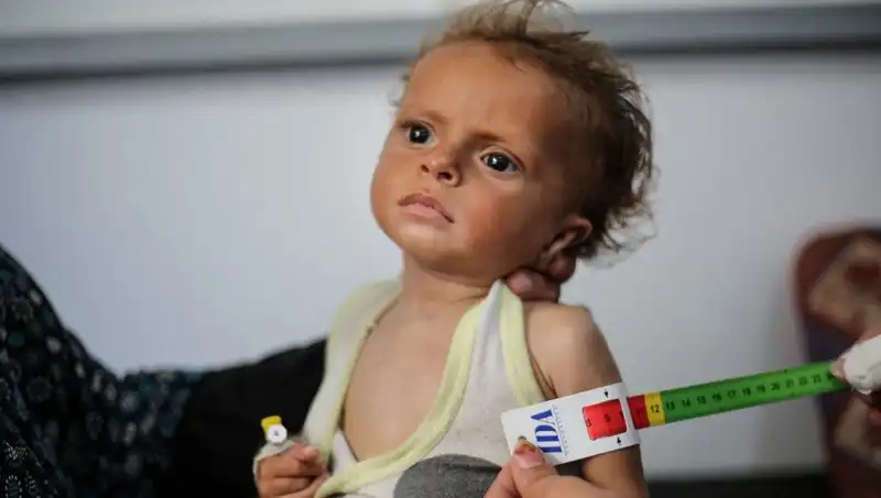 İngiltere'den Umut: 300 Gazzeli Çocuğa Geçici Misafirlik Yapılacak